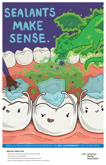 Dental Sealant Poster
